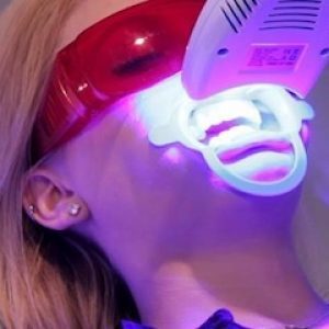 Tratamento com laser para perda óssea dentária