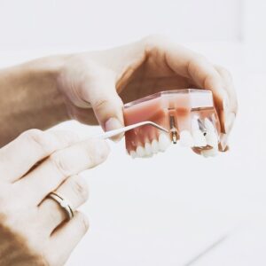 Imagem de um dentista mostrando o modelo de uma boca com implante dentário