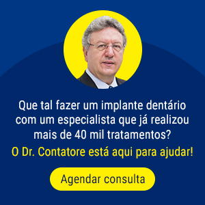 Banner de implante dentário em São Paulo