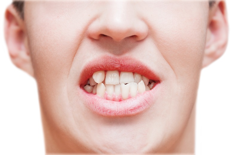 Imagem de um homem mostrando os dentes tortos em uma clínica de ortodontia em São Paulo