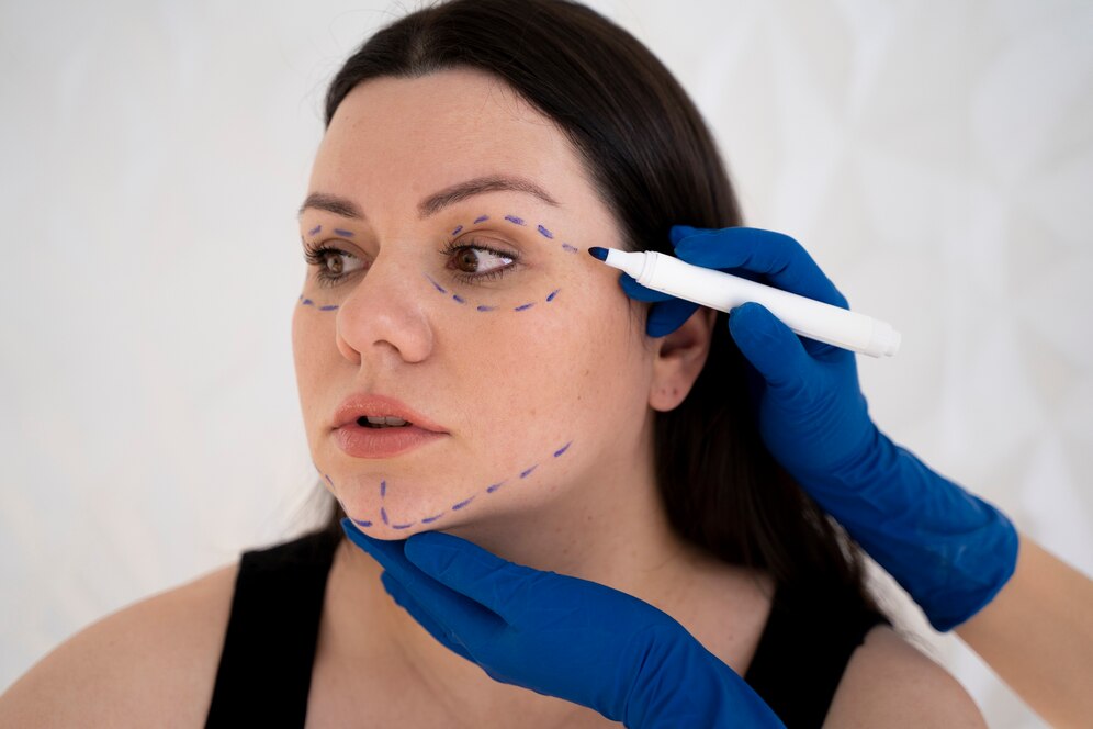 A imagem mostra um exemplo de uma mulher se preparando para realizar uma harmonização orofacial.