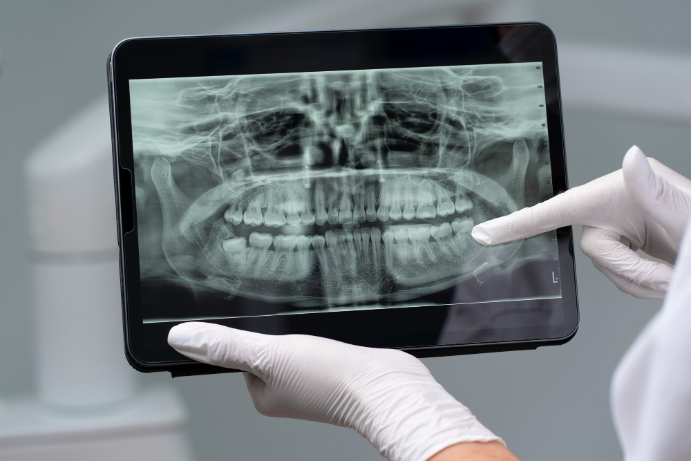 A imagem mostra um raio-X dentário