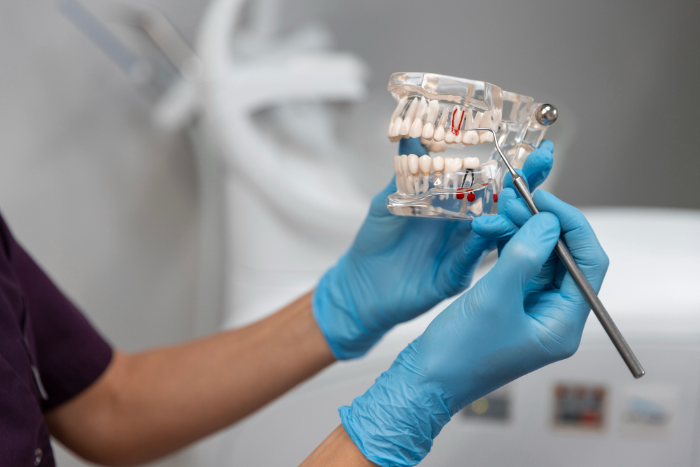A imagem mostra um implante dentário