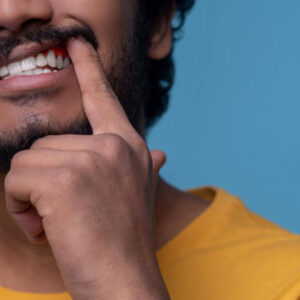 Homem adulto mostrando sua doença periodontal diante da câmera